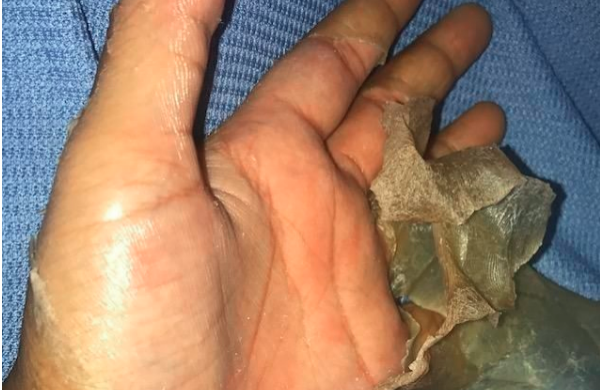 Morse code Hearty Aquarium Joven casi muere al sufrir shock tóxico por usar tampones - El Sol de Nayarit Morse code Hearty Aquarium Joven casi muere al sufrir shock tóxico por usar tampones - El Sol de Nayarit